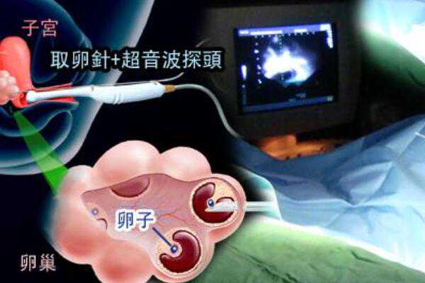 <b>武汉助孕中心哪个好 2023武汉纵隔子宫患者试管医院排名 ‘38周四维彩超男胎儿</b>